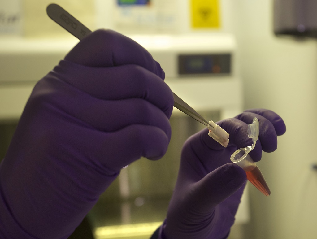 biosensor VIH
