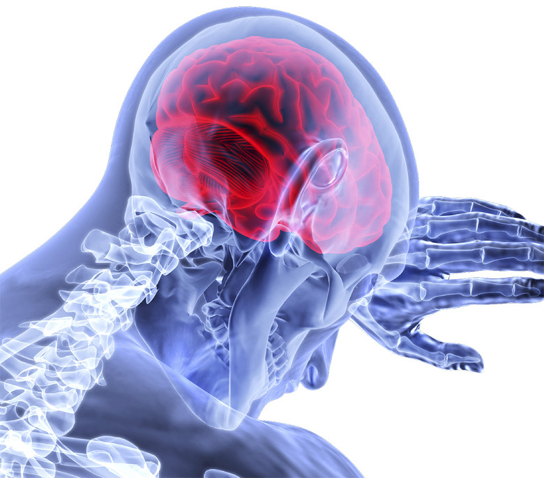 infarto cerebral