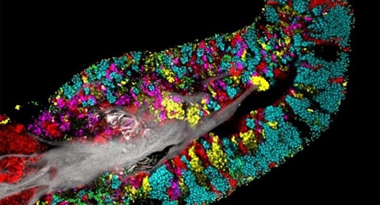 bacterias en la lengua