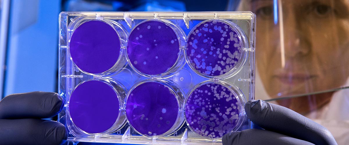 tratamientos con bacteriófagos en medicina