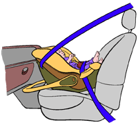Airbag frontal y SRI