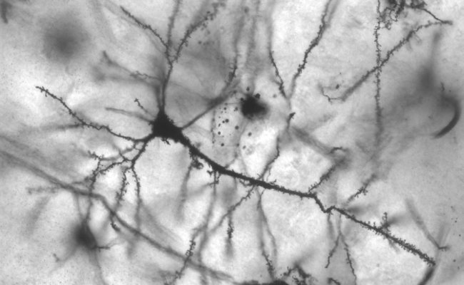 Neuronas