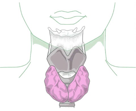 Tiroides