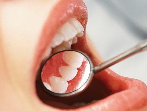 dientes
